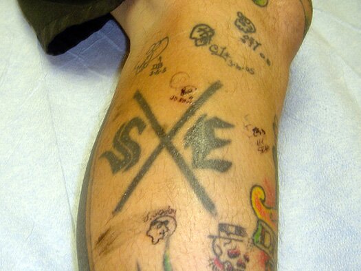 Sxe